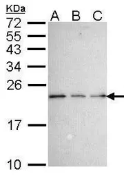 Anti-NADE antibody [N1C3] used in Western Blot (WB). GTX102376