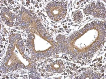 Anti-SERCA3 antibody [N1N2], N-term used in IHC (Paraffin sections) (IHC-P). GTX102381