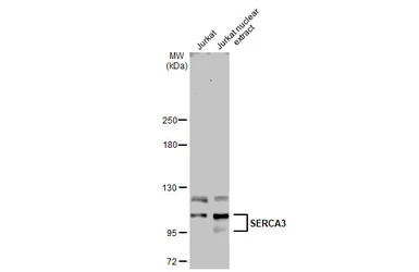 Anti-SERCA3 antibody [N1N2], N-term used in Western Blot (WB). GTX102381