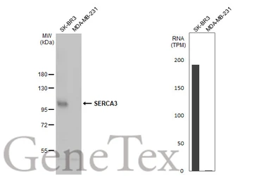 Anti-SERCA3 antibody [N1N2], N-term used in Western Blot (WB). GTX102381