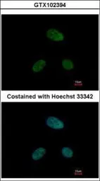 Anti-DRAK1 antibody [N1C1] used in Immunocytochemistry/ Immunofluorescence (ICC/IF). GTX102394
