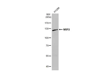 Anti-NRP2 antibody [N2N3] used in Western Blot (WB). GTX102397