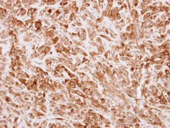 Anti-TRIP antibody [N3C2], Internal used in IHC (Paraffin sections) (IHC-P). GTX102402