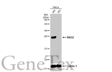 Anti-BAG2 antibody used in Western Blot (WB). GTX102406