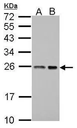 Anti-BAG2 antibody used in Western Blot (WB). GTX102406