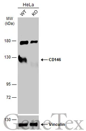 Anti-CD146 antibody [N1N3] used in Western Blot (WB). GTX102413