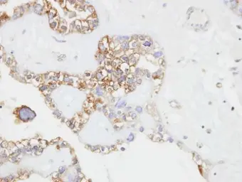Anti-CD146 antibody [N1N3] used in IHC (Paraffin sections) (IHC-P). GTX102413