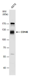Anti-CD146 antibody [N1N3] used in Western Blot (WB). GTX102413