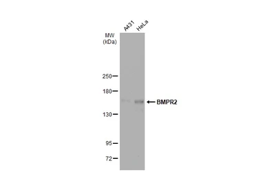 Anti-BMPR2 antibody [C1C3] used in Western Blot (WB). GTX102418