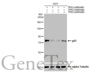 Anti-p63 antibody [N2C1], Internal used in Western Blot (WB). GTX102425