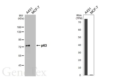 Anti-p63 antibody [N2C1], Internal used in Western Blot (WB). GTX102425