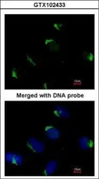 Anti-Bag1 antibody [N3C3] used in Immunocytochemistry/ Immunofluorescence (ICC/IF). GTX102433