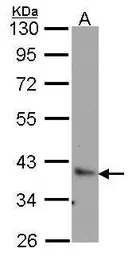 Anti-Bag1 antibody [N3C3] used in Western Blot (WB). GTX102433