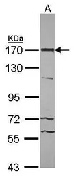 Anti-53BP2 / ASPP2 antibody [C1C2], Internal used in Western Blot (WB). GTX102434
