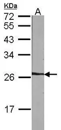 Anti-NME5 antibody [N1C3] used in Western Blot (WB). GTX102475