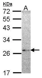 Anti-NME5 antibody [N1C3] used in Western Blot (WB). GTX102475