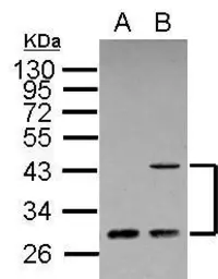 Anti-ING1 antibody [C1C3] used in Western Blot (WB). GTX102478