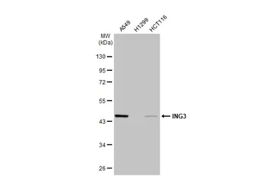 Anti-ING3 antibody [N2N3] used in Western Blot (WB). GTX102480