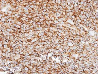 Anti-GRK3 antibody [N1N2], N-term used in IHC (Paraffin sections) (IHC-P). GTX102493