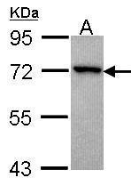 Anti-GRK3 antibody [N1N2], N-term used in Western Blot (WB). GTX102493