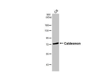 Anti-Caldesmon antibody [N1N2], N-term used in Western Blot (WB). GTX102498