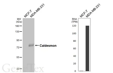 Anti-Caldesmon antibody [N1N2], N-term used in Western Blot (WB). GTX102498