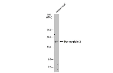 Anti-Desmoglein 2 antibody [N1N2], N-term used in Western Blot (WB). GTX102508