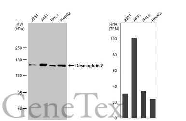 Anti-Desmoglein 2 antibody [N1N2], N-term used in Western Blot (WB). GTX102508