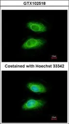 Anti-IRAK2 antibody [N2C1], Internal used in Immunocytochemistry/ Immunofluorescence (ICC/IF). GTX102518