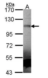 Anti-MUSK antibody [N1N2], N-term used in Western Blot (WB). GTX102521