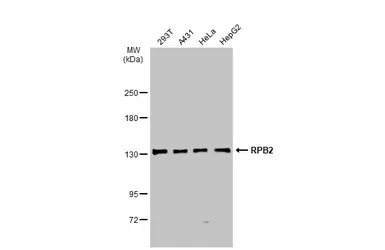 Anti-RPB2 antibody [N1], N-term used in Western Blot (WB). GTX102535