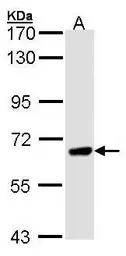 Anti-PPEF1 antibody [N1N2], N-term used in Western Blot (WB). GTX102537