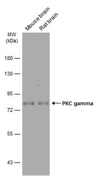 Anti-PKC gamma antibody used in Western Blot (WB). GTX102539
