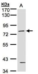 Anti-PKC gamma antibody used in Western Blot (WB). GTX102539