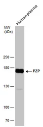 Anti-PZP antibody used in Western Blot (WB). GTX102547