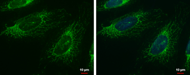 Anti-FAST antibody used in Immunocytochemistry/ Immunofluorescence (ICC/IF). GTX102571