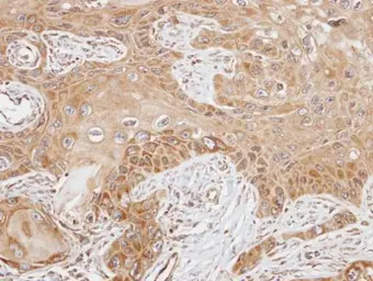 Anti-FAST antibody used in IHC (Paraffin sections) (IHC-P). GTX102571