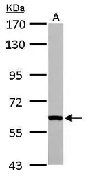 Anti-FAST antibody used in Western Blot (WB). GTX102571