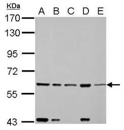 Anti-FAST antibody used in Western Blot (WB). GTX102571