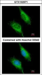 Anti-FAST antibody used in Immunocytochemistry/ Immunofluorescence (ICC/IF). GTX102571