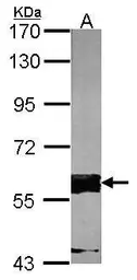 Anti-FAST antibody used in Western Blot (WB). GTX102571