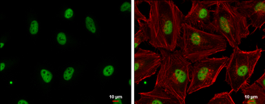 Anti-GABPA antibody [N2C2], Internal used in Immunocytochemistry/ Immunofluorescence (ICC/IF). GTX102572