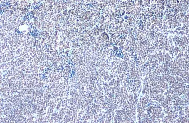 Anti-GABPA antibody [N2C2], Internal used in IHC (Paraffin sections) (IHC-P). GTX102572