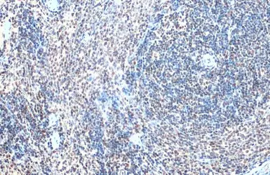 Anti-GABPA antibody [N2C2], Internal used in IHC (Paraffin sections) (IHC-P). GTX102572
