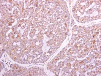 Anti-TLR2 antibody [N1N2], N-term used in IHC (Paraffin sections) (IHC-P). GTX102577