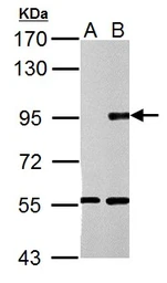 Anti-TLR2 antibody [N1N2], N-term used in Western Blot (WB). GTX102577