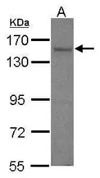 Anti-AKAP1 antibody [C2C3], C-term used in Western Blot (WB). GTX102578