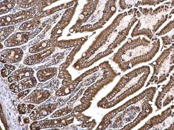 Anti-Grp78 antibody [N2C1], Internal used in IHC (Paraffin sections) (IHC-P). GTX102580