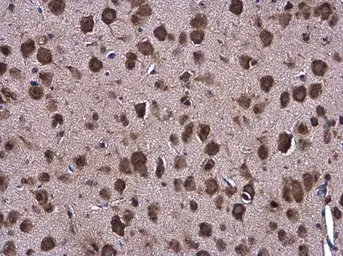 Anti-Grp78 antibody [N2C1], Internal used in IHC (Paraffin sections) (IHC-P). GTX102580