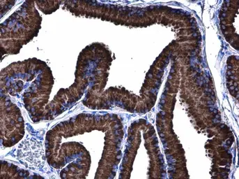 Anti-Grp78 antibody [N2C1], Internal used in IHC (Paraffin sections) (IHC-P). GTX102580